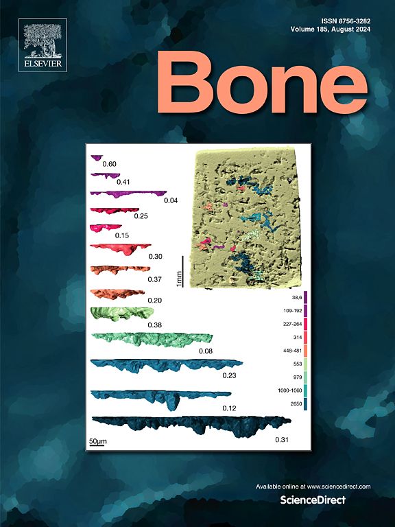 Quantitative 3D analysis of bone resorption events