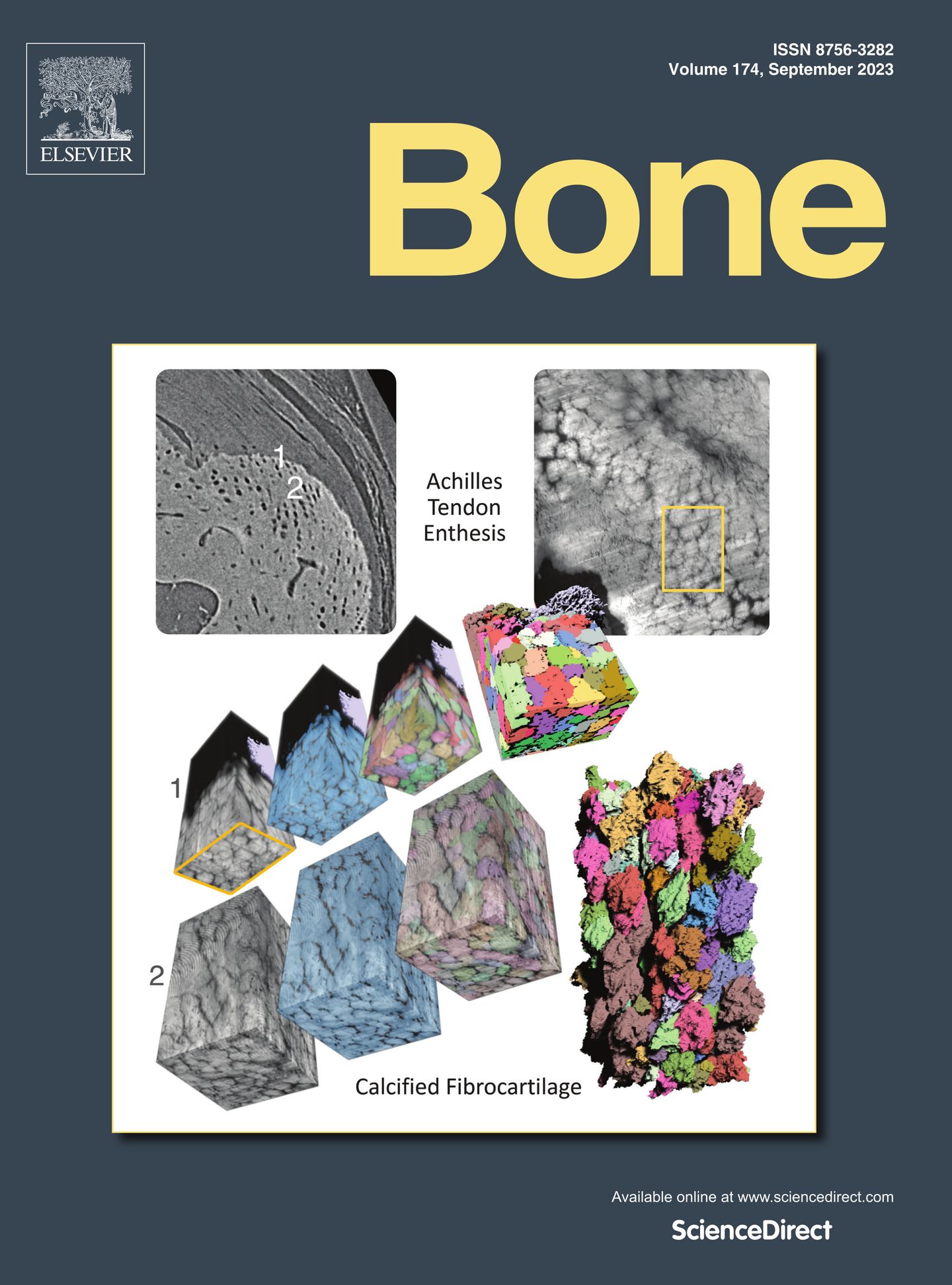 Mineralization at the enthesis